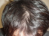 2007010706