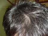 2007061609