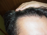 2007061610