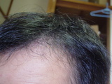 2006112104