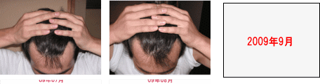正面比較7〜8(2)