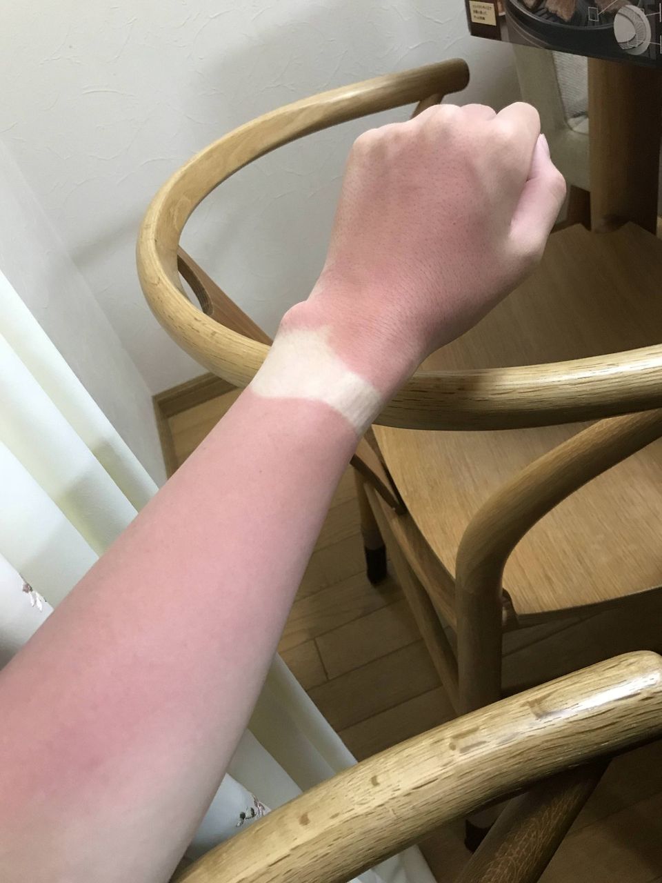 日焼けで腕時計の型がついて恥ずかしいことになってるんだがwww(※画像あり)