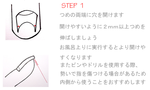 巻き爪1