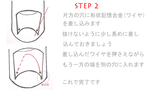 巻き爪2