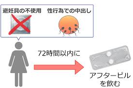 セフレに中出しされた