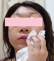 ジェルパック完了