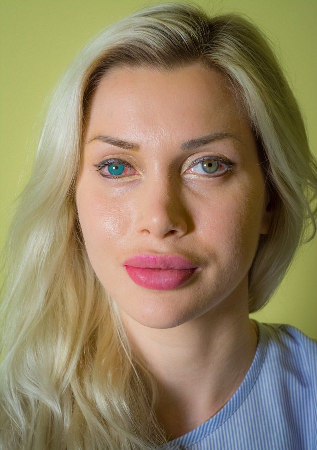 What Are Sia S Natural Eye And Hair Color What Are Sia S Natural Eye And Hair Color