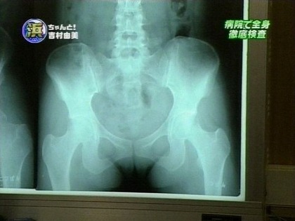 016