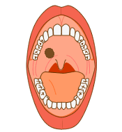 中 に の 物 出来 口 黒い 口の中に発生する「できもの」を解説！口内炎から、口腔癌の兆候まで網羅