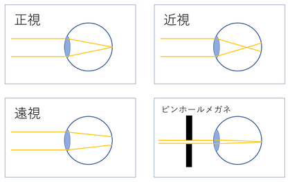 目のイラスト