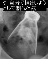 a_37_1