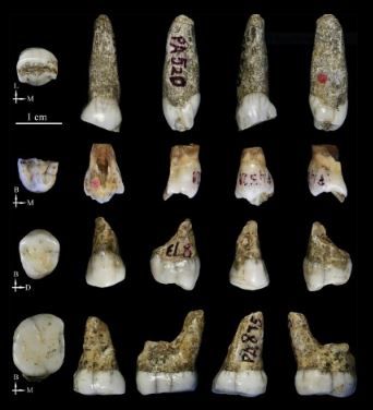 teeth