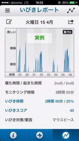 いびきの解析結果の表示