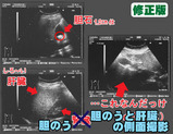 おなかの中を特別大公開!(修正版