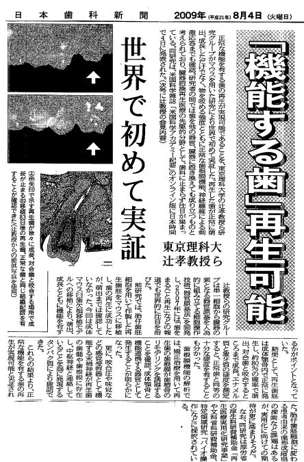 4 日本歯科新聞記事 歯再生