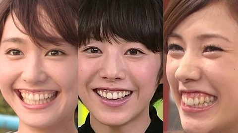 entertainer-gummy-smile09