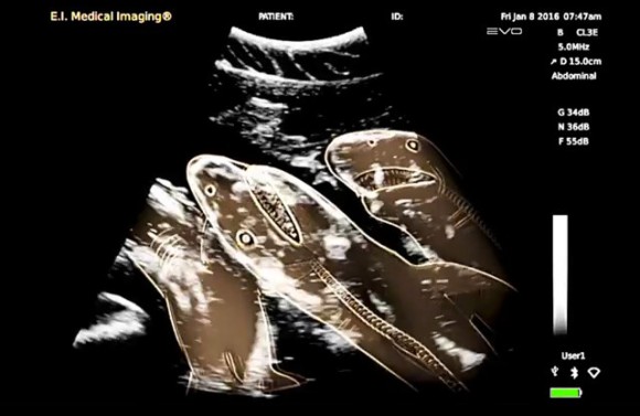 史上初！これが妊娠したイタチザメの腹部の超音波映像だ！