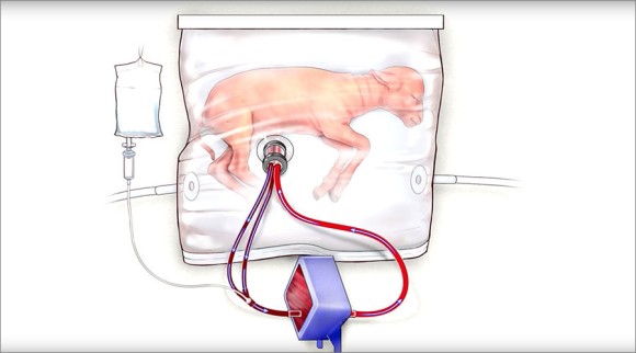 ビニール袋のような人工子宮の中で羊の胎児を育てることに成功。未熟児の命を救う（米研究）