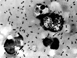 黒死病患者の墓地から掘り出した遺体から判明、ペスト菌は600年前から変化せず