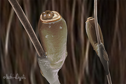 body-lice-eggs-sig