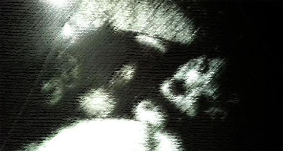 完全にホラーと化してしまった、胎児の超音波画像（閲覧注意）