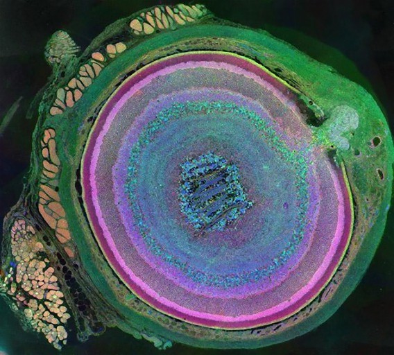 5_e