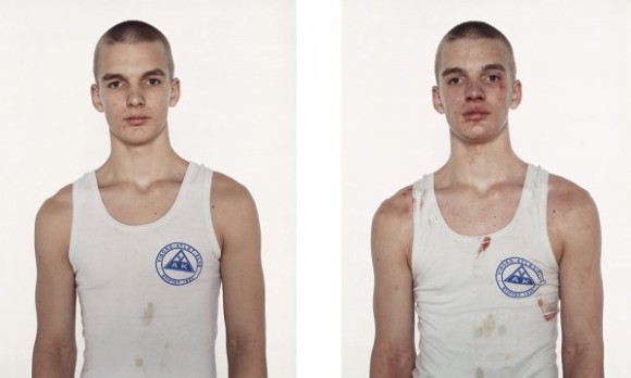 nicolai-howalt-boxers-before-and-after-07_e