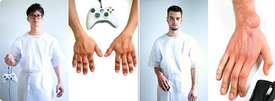 ゲームを長期間やりすぎると人間の体はどのように変化していくのか？「Game Arthritis」