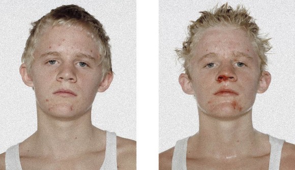 デンマークのアマチュア少年ボクサーたち、初めての試合前と後を撮影したポートレート、ビフォア・アフター。