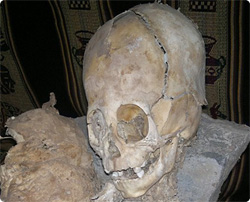 エイリアン疑惑？ペルーで見つかった頭がやけに細長い頭蓋骨（画像・動画）