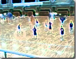 バレーの試合中に消えた右足