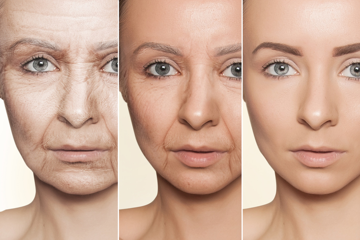 iStock-1128919958