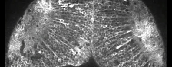 魚の脳に写される視覚世界を可視化することに成功（国立遺伝学研究所）