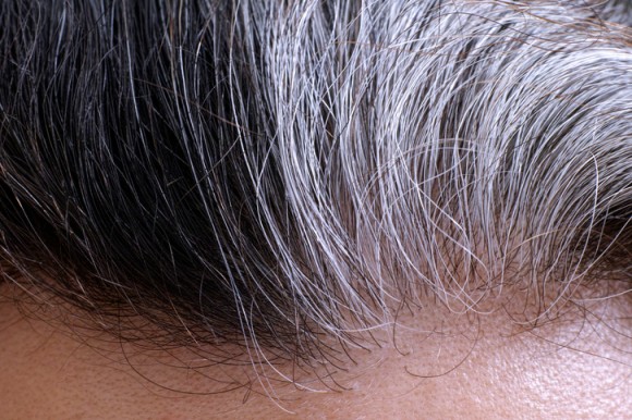 ストレスで白髪が増えるは本当だった。 ストレスホルモンを制御する遺伝子が色を作る毛包を変化させる（米研究）