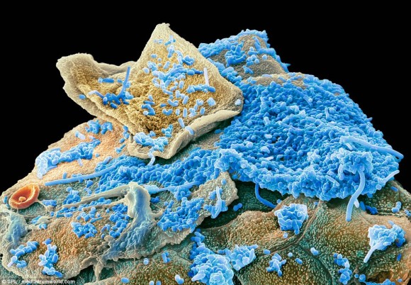 こんなのいた！口の中にいる細菌をマクロ写真で見てみよう