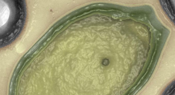 研究史上最大の巨大ウイルスがチリ沖で発見される