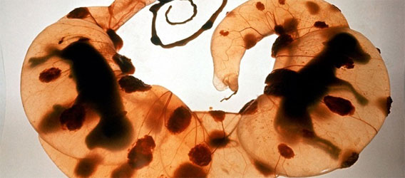 科学写真家が撮影した、科学の進歩がわかる貴重な写真