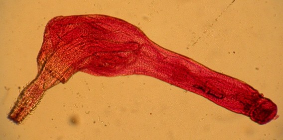 4_e17