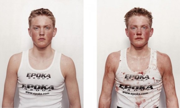 nicolai-howalt-boxers-before-and-after-06_e