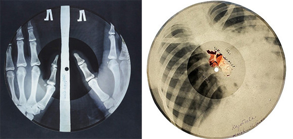 ソ連時代、海賊版のレコードはレントゲン写真のフィルムに焼かれていた