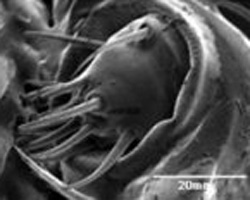 宇宙生存可能種？真空でも生きていけるダニ、電子顕微鏡で生存確認（動画）