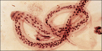 filarial