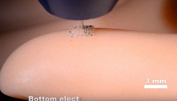 ロボットに触覚を与える生体スキンが3Dプリント技術で開発される（米研究）