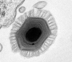 南米チリ沖で世界最大の「メガウイルス」が発見される