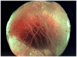 全てを覆いこんで固めていく空間コンポーネント、「神秘の氷の世界」