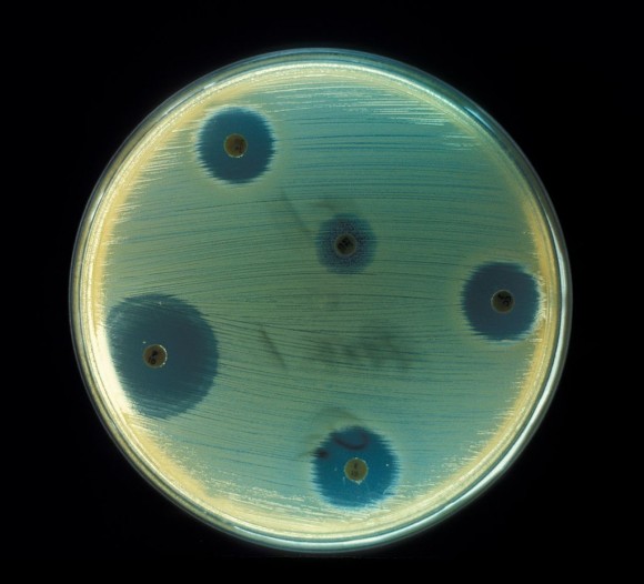 本当に怖い、もしもの世界。もしも世界に抗生物質が存在しなかったら・・・起こりうるであろう10のこと