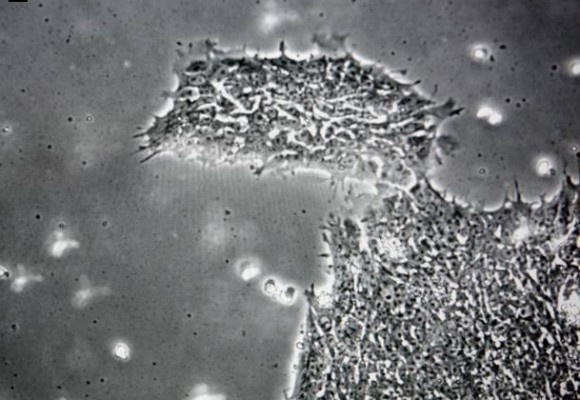1_e1
