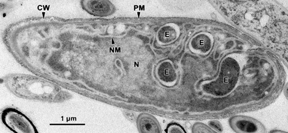 八丈島沖の海底、未知の微生物発見か？（千葉大研究）