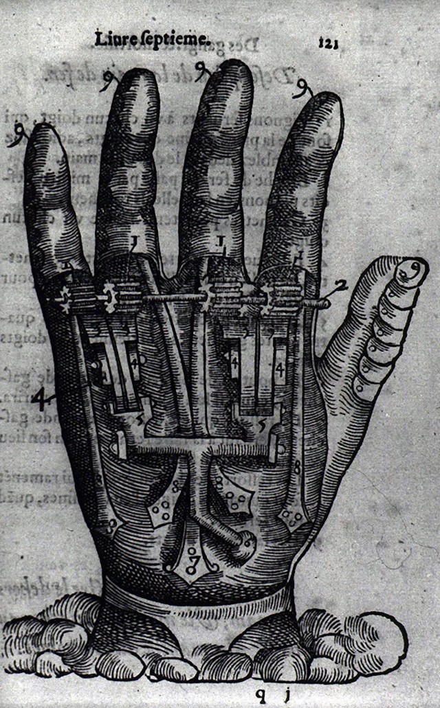 人工装具の発明者「アンブロワーズ・パレ」とその後の義肢に関する歴史