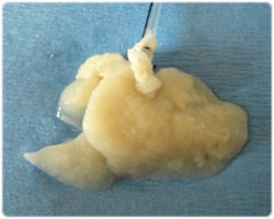 人間の細胞から人工肝臓を作り出すことに成功（米研究所）